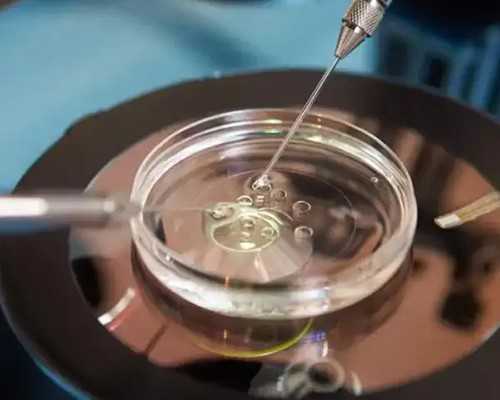 青岛供卵试管婴儿价格,青岛供卵试管婴儿介绍